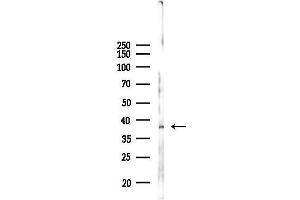 anti-Acidic (Leucine-Rich) Nuclear phosphoprotein 32 Family, Member E (ANP32E) antibody