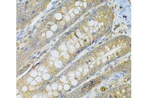 Immunohistochemistry of paraffin-embedded Rat intestine using SERPINA6 Polyclonal Antibody at dilution of 1:100 (40x lens).