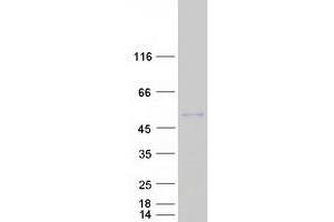 Validation with Western Blot