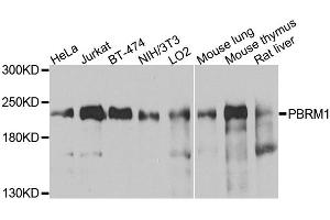Western blot analysis of extracts of various cell lines, using PBRM1 antibody. (Polybromo 1 anticorps)