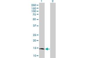 Western Blot analysis of RARRES2 expression in transfected 293T cell line by RARRES2 MaxPab polyclonal antibody. (Chemerin anticorps  (AA 1-163))