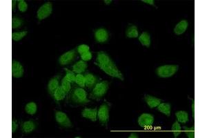 Image no. 4 for anti-Non-SMC Condensin I Complex, Subunit D2 (NCAPD2) (AA 1240-1339) antibody (ABIN599100) (NCAPD2 anticorps  (AA 1240-1339))