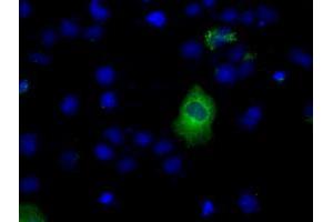 Image no. 8 for anti-Lipase, Endothelial (LIPG) antibody (ABIN1499164) (LIPG anticorps)