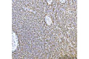 IHC analysis of ERP29 using anti-ERP29 antibody (ABIN7601342).
