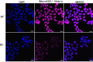 Immunocytochemical staining of HeLa cells using MacroH2A. (Recombinant Histone, H2A1, Macro anticorps)