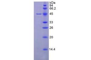 SDS-PAGE analysis of Human GPX4 Protein. (GPX4 Protéine)
