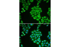 Immunofluorescence analysis of HeLa cell using EPPIN antibody. (Eppin anticorps)