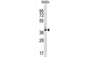 Western Blotting (WB) image for anti-Pepsinogen 4, Group I (Pepsinogen A) (PGA4) antibody (ABIN2995157) (PGA4 anticorps)