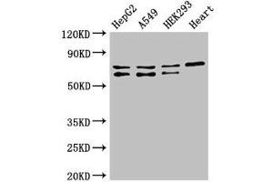 Western Blot Positive WB detected in: HepG2 whole cell lysate, A549 whole cell lysate, HEK293 whole cell lysate, Mouse heart tissue All lanes: HIF3A antibody at 2. (HIF3A anticorps  (AA 516-669))