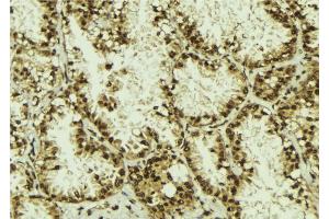 ABIN6273114 at 1/100 staining Human lung tissue by IHC-P. (DYX1C1 anticorps)