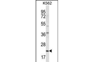 HLA-DQA1 Antibody (Center) (ABIN656168 and ABIN2845498) western blot analysis in K562 cell line lysates (35 μg/lane). (HLA-DQA1 anticorps  (AA 57-84))