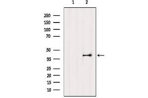 Western blot analysis of extracts from Mouse lung, using EDG3 Antibody. (S1PR3 anticorps  (N-Term))