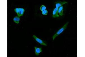 IF analysis of PDE6 beta/PDE6B using anti-PDE6 beta/PDE6B antibody (ABIN7600893). (PDE6B anticorps  (AA 25-237))