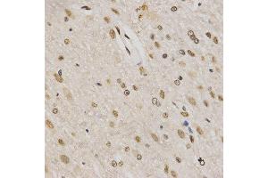 Immunohistochemistry of paraffin-embedded rat brain tissue using H3K79me3 antibody at dilution of 1:200 (x400 lens). (Histone 3 anticorps  (H3K79me3))