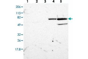 Western blot analysis of Lane 1: RT-4, Lane 2: U-251 MG, Lane 3: A-431, Lane 4: Liver, Lane 5: Tonsil with ZNF234 polyclonal antibody  at 1:250-1:500 dilution. (ZNF234 anticorps)