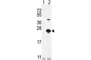 Western Blotting (WB) image for anti-Epithelial Mitogen (EPGN) antibody (ABIN2996100) (Epigen anticorps)