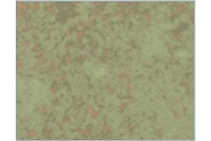 Immunohistochemistry analysis of Listeria infected mice spleens 6 days after infection with L-monocytogenes using AM03145PU (Clone LK2). (HSPD1 anticorps)
