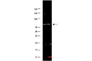Western blot using  affinity purified anti-FANCG antibody shows detection of a band at ~69 kDa (arrowhead) corresponding to FANCG present in a HeLa whole cell lysate.