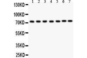 Anti- GCLC antibody, Western blotting All lanes: Anti GCLC  at 0. (GCLC anticorps  (AA 437-637))