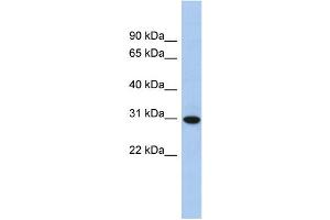 WB Suggested Anti-TMED8 Antibody Titration: 0. (TMED8 anticorps  (Middle Region))
