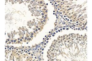 ABIN6257888 and ABIN6275082 at 1/100 staining rat testis tissue by IHC-P. (DNAI2 anticorps  (N-Term))