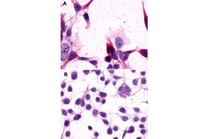 Immunocytochemistry (ICC) staining of HEK293 human embryonic kidney cells transfected (A) or untransfected (B) with GRM3. (Metabotropic Glutamate Receptor 3 anticorps  (Extracellular Domain))