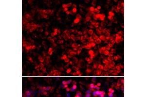 Immunofluorescence analysis of U2OS cells using QARS Polyclonal Antibody (QARS anticorps)