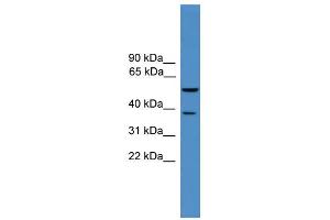 WB Suggested Anti-Bace1 Antibody Titration: 0. (BACE1 anticorps  (Middle Region))