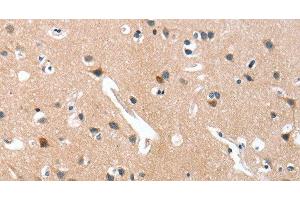 Immunohistochemistry of paraffin-embedded Human brain tissue using GRB7 Polyclonal Antibody at dilution 1:40 (GRB7 anticorps)