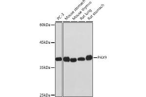 Western blot analysis of extracts of various cell lines, using P Rabbit mAb (ABIN7269156) at 1:1000 dilution. (PAX9 anticorps)