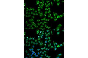 Immunofluorescence analysis of U2OS cells using LMNB2 antibody (ABIN5973877). (Lamin B2 anticorps)