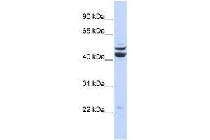 WB Suggested Anti-PKNOX2 Antibody Titration:  0. (PKNOX2 anticorps  (Middle Region))