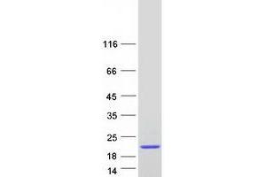 Validation with Western Blot