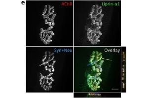 Liprin-α-1 localizes to Z-discs and NMJs in skeletal muscles.
