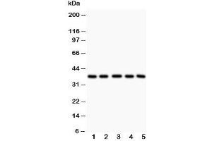 Western blot testing of LOX-1 antibody and Lane 1:  rat liver;  2: human HeLa;  3: (h) K562;  4: (h) Raji lysate. (OLR1 anticorps  (Middle Region))