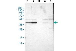 Western blot analysis of Lane 1: RT-4, Lane 2: U-251 MG, Lane 3: Human Plasma, Lane 4: Liver, Lane 5: Tonsil with WDR53 polyclonal antibody  at 1:250-1:500 dilution. (WDR53 anticorps)