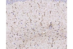 Immunohistochemistry analysis of paraffin-embedded mouse brain using GFAP Monoclonal Antibody at dilution of 1:400.