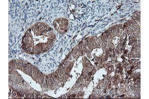 Image no. 2 for anti-LIM Domain Kinase 1 (LIMK1) antibody (ABIN1499146)