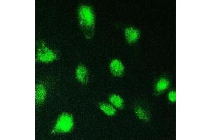 IF analysis of KBTBD2 using anti-KBTBD2 antibody (ABIN6719647). (KBTBD2 anticorps)