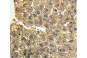 IHC-P analysis of Liver tissue, with DAB staining. (GDF2 anticorps  (AA 241-418))