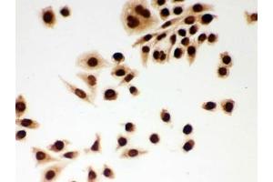 ICC testing of FFPE human SMMC-7721 cells with DDB1 antibody. (DDB1 anticorps  (AA 1011-1140))