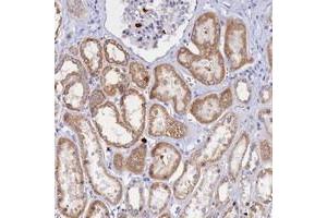 Immunohistochemical staining of human kidney with SLC26A1 polyclonal antibody  shows moderate cytoplasmic positivity in cells in tubules at 1:1000-1:2500 dilution.