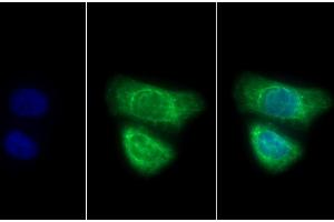 Detection of CK7 in Human HepG2 cell using Polyclonal Antibody to Cytokeratin 7 (CK7) (Cytokeratin 7 anticorps  (AA 91-394))
