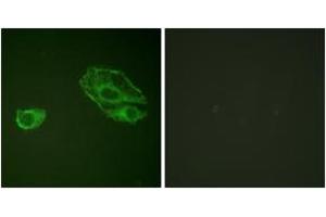 Immunofluorescence analysis of A549 cells, using HER3 (Ab-1289) Antibody. (ERBB3 anticorps  (AA 1256-1305))