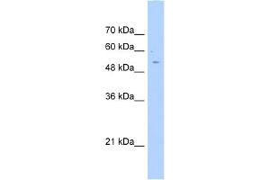WB Suggested Anti-AGXT2L2 Antibody Titration:  0. (AGXT2L2 anticorps  (C-Term))