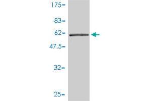 Western Blot detection against Immunogen (53. (Tropomyosin 4 anticorps  (AA 1-248))