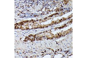 Immunohistochemistry of paraffin-embedded rat lung using GA antibody (ABIN6130412, ABIN6140923, ABIN6140926 and ABIN6215461) at dilution of 1:100 (40x lens). (GADD45A anticorps  (AA 1-165))