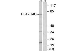 Western blot analysis of extracts from Jurkat cells, using PLA2G4C antibody.