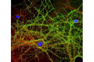 Mixed neuron-glial cultures stained with ABIN1580420 (green) and rabbit antibody to alpha-II spectrin (red), and DNA (blue). (GAP43 anticorps)