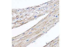 Immunohistochemistry of paraffin-embedded mouse heart using RPL8 Rabbit pAb (ABIN6128659, ABIN6147155, ABIN6147156 and ABIN6214154) at dilution of 1:50 (40x lens).